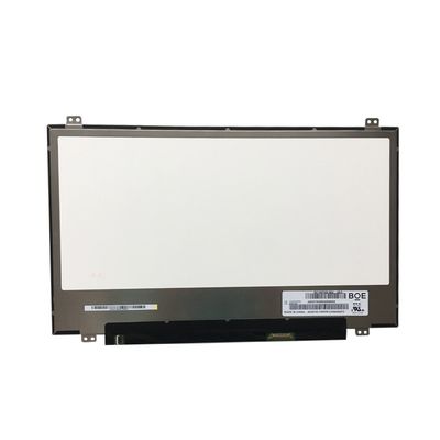 LP156WF6-SPP1 LG Display 15.6&quot; 1920(RGB)×1080 300 cd/m² TAMPILAN LCD INDUSTRI